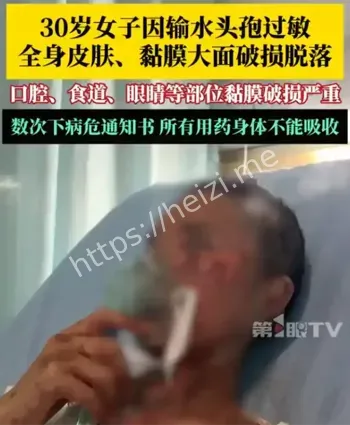输头孢过敏
