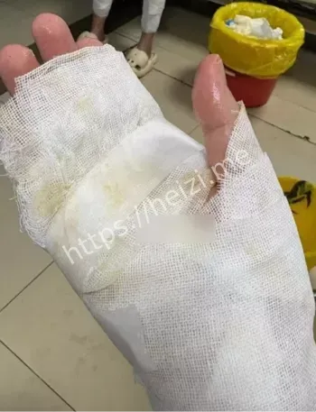 户外活动安全隐患