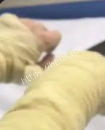 湖南永州女主播快递炸伤案