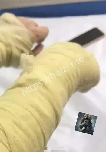 粉丝追求拒绝酿报复惨剧