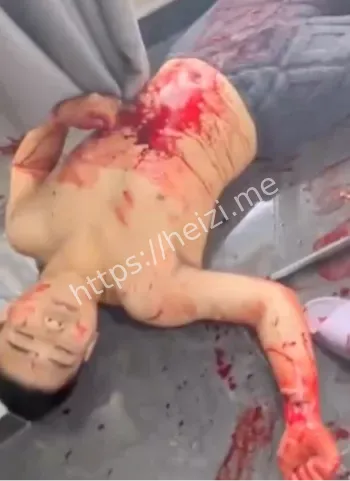 精神小伙杀人事件